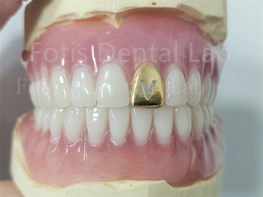 Prothèse dentaire en acrylique avec dents naturelles