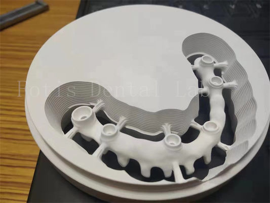 Implant dentaire poli hygiénique couronne de zirconium conception personnalisable