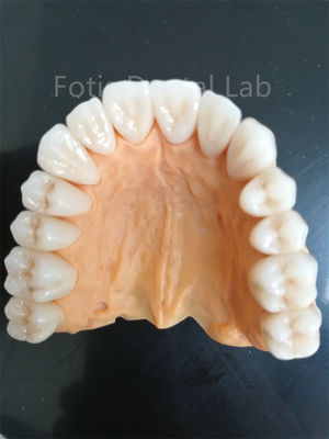 Zirconia multicouche avancée pour une résistance supérieure à l'usure et à la corrosion