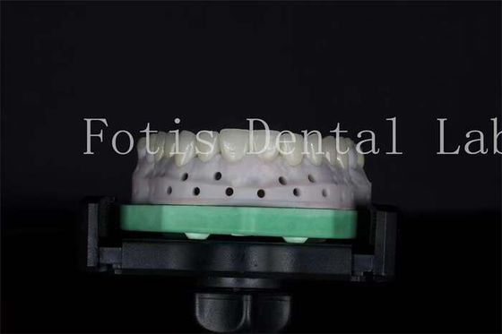 acheter Veneurs de laboratoire dentaire de haute résistance personnalisables pour des sourires naturels online manufacture