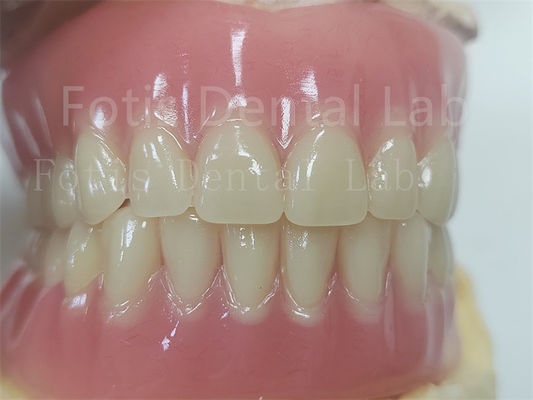 acheter Comfort Prothèse dentaire en acrylique pour prothèses dentaires précises online manufacture