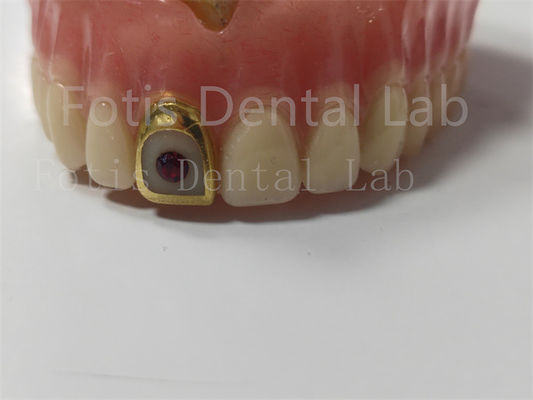 acheter Prothèse complète en acrylique confortable pour les professionnels résistante aux taches et aux odeurs online manufacture