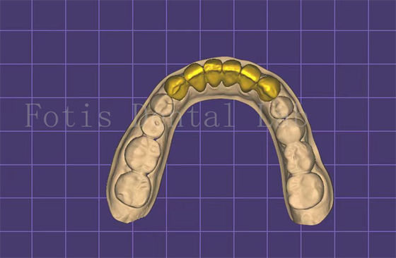 acheter Fabricant de modèles de bouche dentaire personnalisable Autoclavable approuvé par la FDA online manufacture
