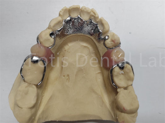 acheter Prothèse dentaire partielle réglable pour dents manquantes online manufacture