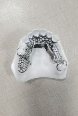 acheter Prothèses dentaires partielles flexibles et de haute stabilité Facile à nettoyer Entretien régulier online manufacture