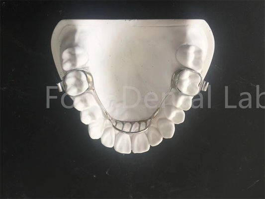 acheter Retenant de dilatation personnalisable Retenant de dilatation palatine Facile à entretenir online manufacture