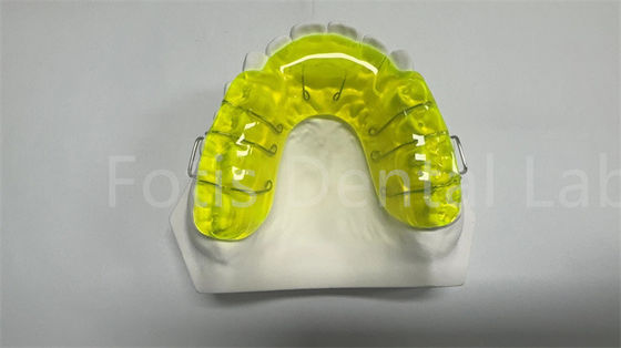 acheter Appareil d' élargissement de retenue Miechigan / appareil d' espacement orthodontique online manufacture