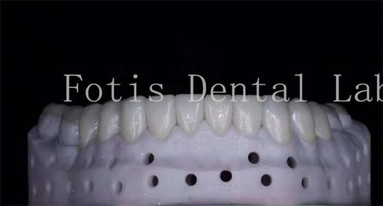 OEM ODM Porcelaine naturelle résistant aux taches Veneurs haute résistance