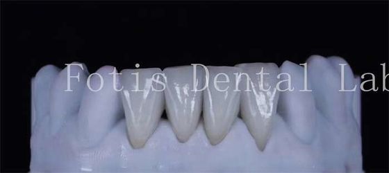 Dents finement laminés en faisceau synthétique 0,3-0,5 mm d'épaisseur Beauté