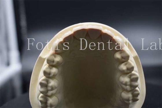Faisceaux de dentition artificielle à haute résistance Faisceaux de porcelaine dentaire