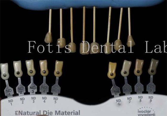 Durable 0,3-0,5 mm épaisseur placage de laboratoire dentaire Faux placage pour les dents