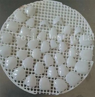 Améliorez votre jeu de polissage avec des couvertures de dents cosmétiques à surface lisse