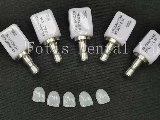 Les facettes dentaires artificielles à haute translucide sont idéales pour une belle dentisterie cosmétique