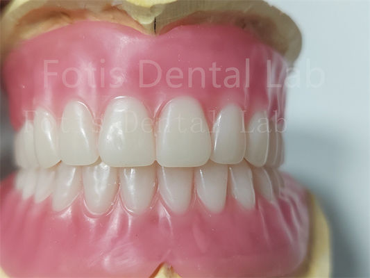Durable couleur naturelle pleine prothèse acrylique sans odeur personnalisation