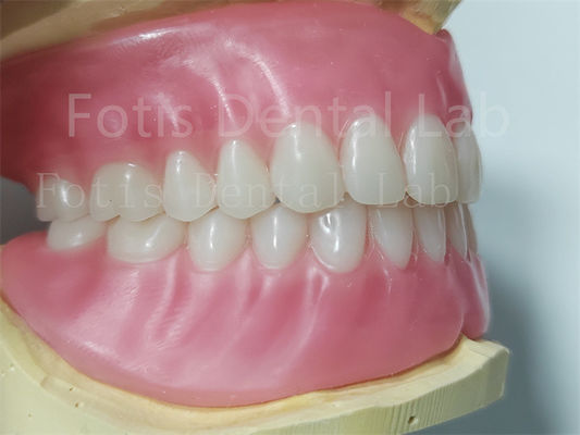 Les dents Ivoclar pleine prothèse dentaire acrylique facile à nettoyer haute durabilité