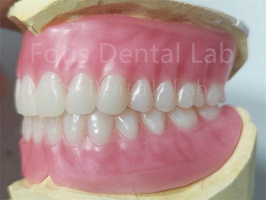 OEM Prothèse acrylique complète supérieure et inférieure Résistance aux taches Couleur naturelle