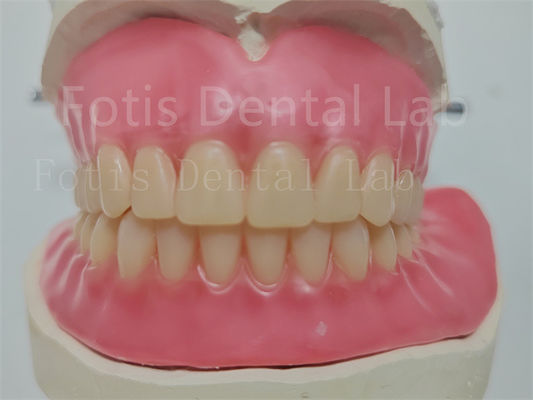 Prothèse dentaire entièrement acrylique personnalisée à prix abordable avec dents Ivoclar facile à utiliser