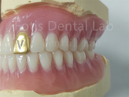 Dents acryliques à prothèse complète personnalisables Résistant aux odeurs Confort
