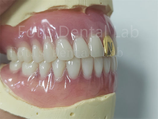Esthétique Ensemble complet de prothèses dentaires acryliques Adaptable personnalisable Facile à nettoyer