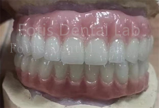 Précisément ajusté Dents Ivoclar Acrylique Denture complète Résistant aux taches