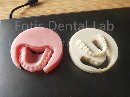 Confort adapté Prothèse dentaire en acrylique pour techniciens professionnels facile à nettoyer