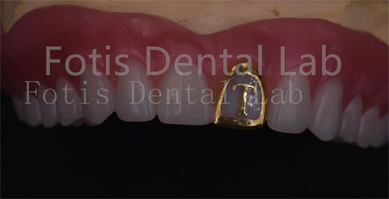 Dentures entièrement acryliques naturelles résistantes aux taches