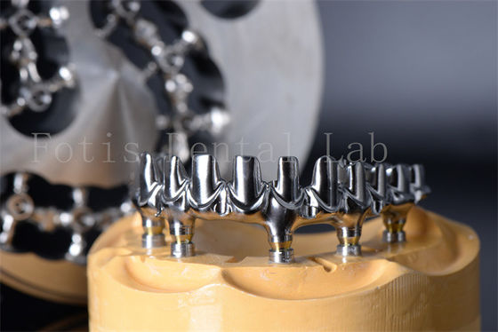 Minimalement invasif, restauration à mâcher, tout sur 4 tout sur 6 dents en titane ou en zirconium