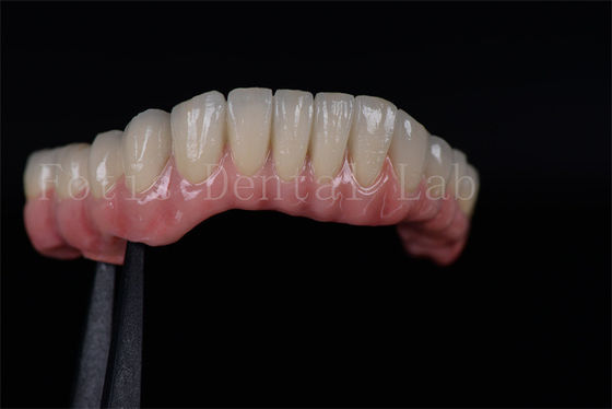 Taux de réussite élevé Tous sur quatre Tous sur six Implants dentaires en titane de zirconium personnalisés