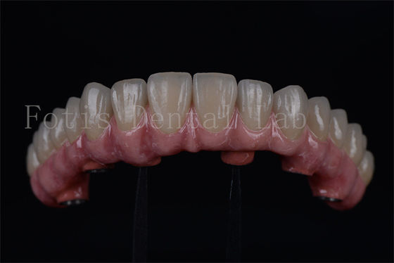 Titane / Zirconia de longue durée tout sur 4 tout sur 6 récupération rapide 1-2 semaines