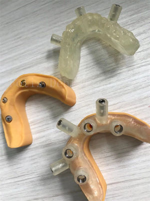 Une couronne artificielle pour implants à haute résistance et à longue durée de vie