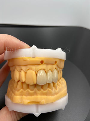 Préciser les couronnes numériques implantées avec le mode de transmission de courrier électronique compatible