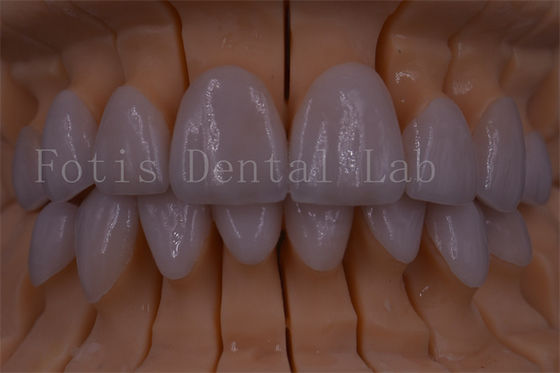 La couronne numérique certifiée FDA/ISO/CE des dents couronne artificielle de n'importe quelle taille