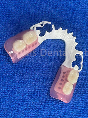 Prothèse dentaire réglable flexible stable confortable prothèse partielle immédiate