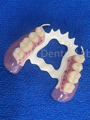 Résistant aux taches Parties dentaires amovibles Stable Remplacer les dents manquantes Prothèse