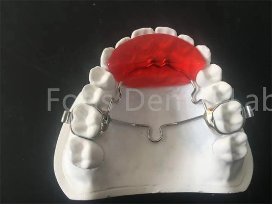 Retenant orthodontique durable, élargissant, port confortable et pratique