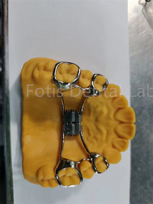 Extensor orthodontique hygiénique facile à nettoyer Retenant dentaire réglable