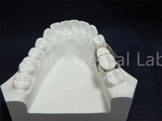 Retenant réglable Expandant Solution orthodontique pratique Entretien facile