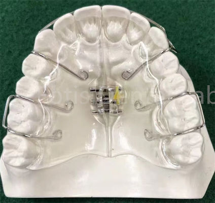 Appareil d'orthodontie à la pointe de la technologie qui élargit le support personnalisable
