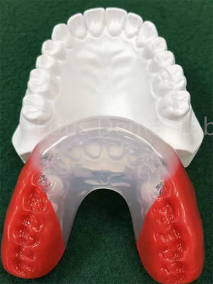 Des appareils orthodontiques de qualité médicale pour un alignement parfait des dents