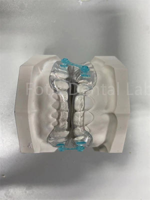 Dispositif de correction orthodontique professionnel confortable