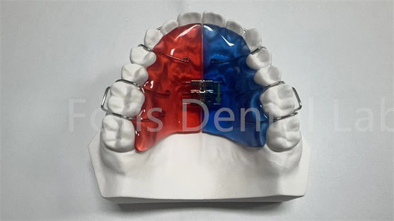 Élargisseur orthodontique individuel pour la correction et l'amélioration des dents
