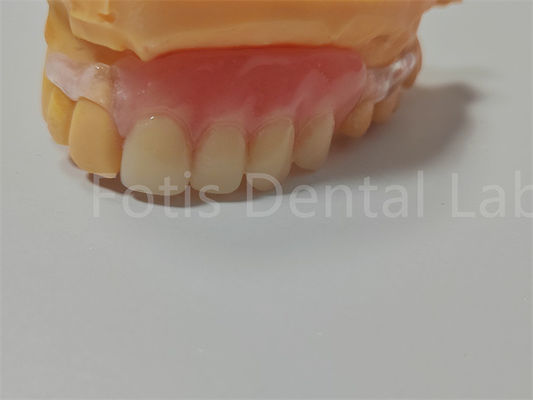 Certification FDA/ISO TCS Valplast Prothèses dentaires flexibles faciles à nettoyer et à ajuster