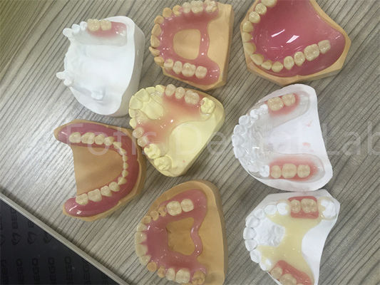 Denture partielle amovible facile à ajuster