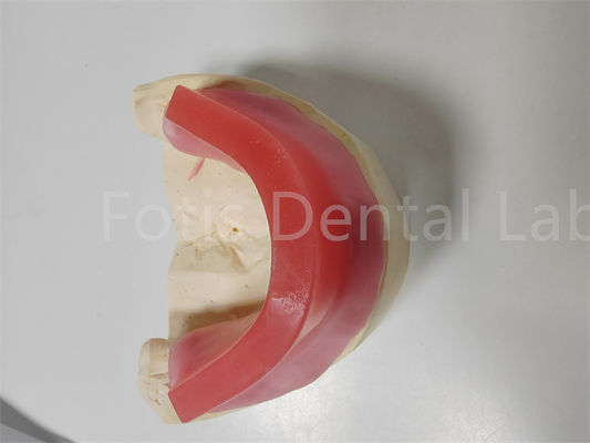 Rings de morsure personnalisés pour les prothèses dentaires Rings à double morsure