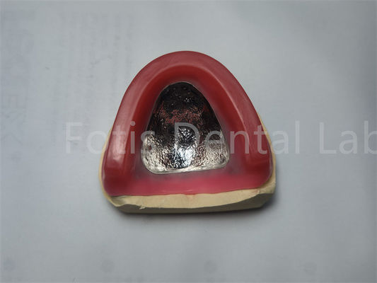 Dentures rouges brillantes et en cire, bordures de contour occlusal, bordure confortable
