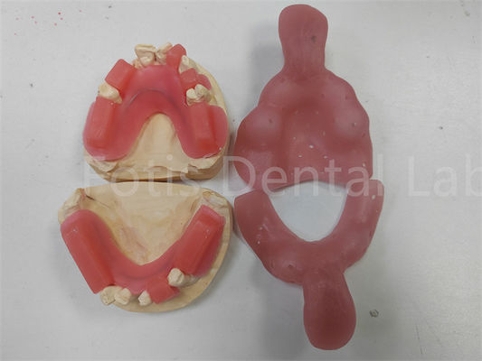 Vibrant rouge pour les dents supérieures ou inférieures Finition brillante Poids léger