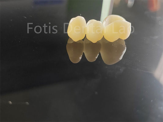 Industrie dentaire Zirconie recouverte de porcelaine solution durable