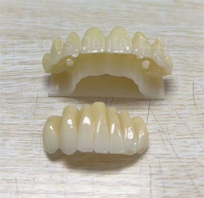 Produit multicouche en zirconium de précision pour améliorer la résistance aux fractures