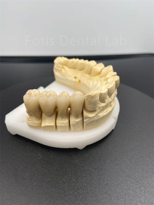 Une bonne performance dentaire en zirconium multicouche La solution céramique ultime