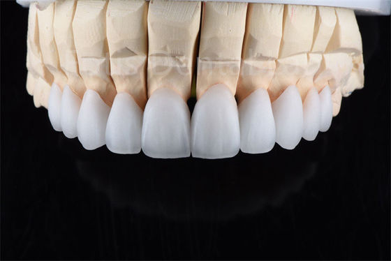 Résistance aux fissures Zirconie multicouche céramique Solution ultime pour l'efficacité industrielle